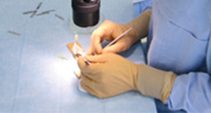 Hair follicle dissection using mantis stereo microscope