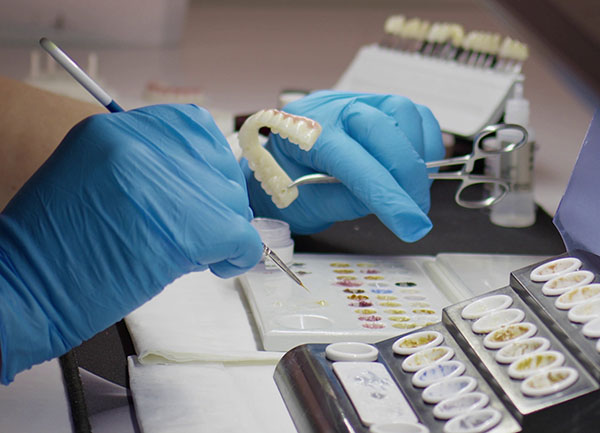 porcelain-and-implant-studies-in-the-dental-laboratory-600×433 A set of dentures being colour matched